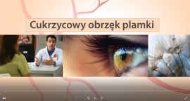 Film 2 Cukrzycowy obrzęk plamki