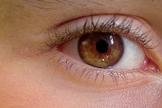 Stan zapalny wewnątrz gałki ocznej po wstrzyknięciu antybiotyku do ciała szklistego i bez tej ochrony
